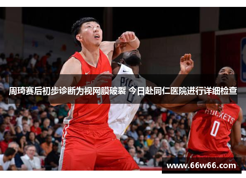 周琦赛后初步诊断为视网膜破裂 今日赴同仁医院进行详细检查